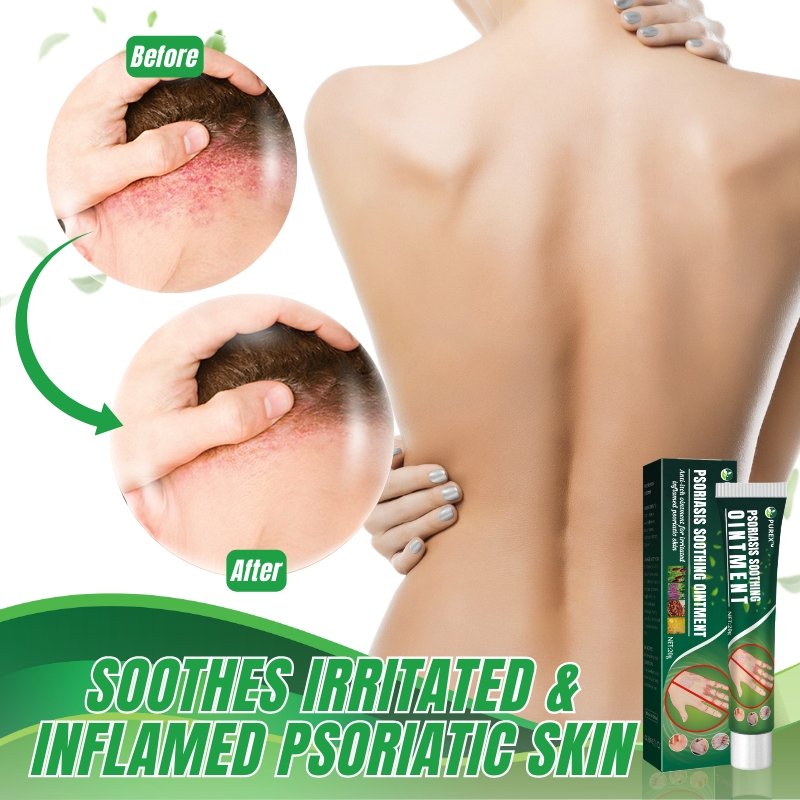 PUREX™ Psoriasis Soothing Ointment